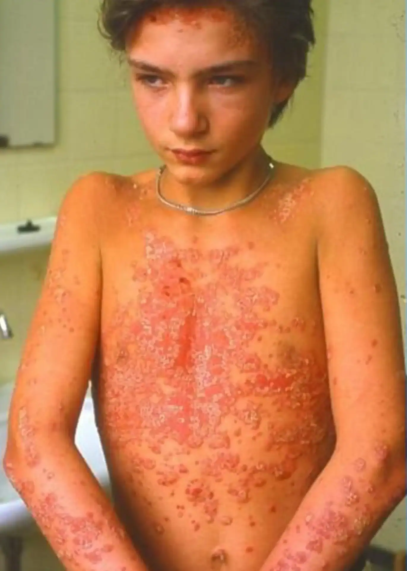 ghk-cu levels decline with age ng/ml Most people think GHK-Cu is just a “beauty peptide.” But look at this… Same  person. Same lighting. Real skin change. GHK-Cu works by activating repair  genes in the body — helping with